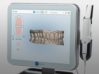 Digital Impresions Gregoire Orthodontics in Auburn and Yarmouth, ME